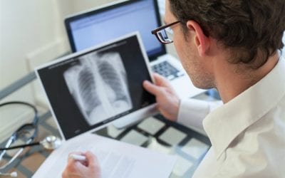 Los casos de tuberculosis en la Argentina aumentaron un 6% entre 2015 y 2017