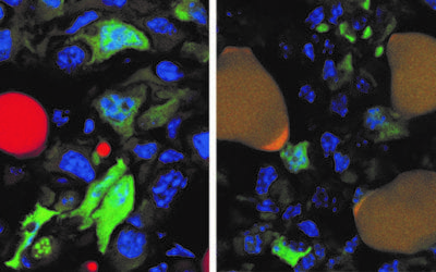 Engañan a las células tumorales para que se conviertan en grasa