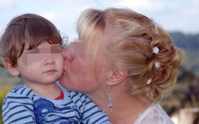 Niño casi queda ciego tras ser contagiado de herpes por un beso