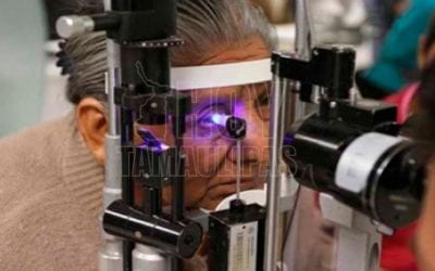 Hoy Tamaulipas – Retinopatia diabetica primera causa de ceguera en adultos mayores