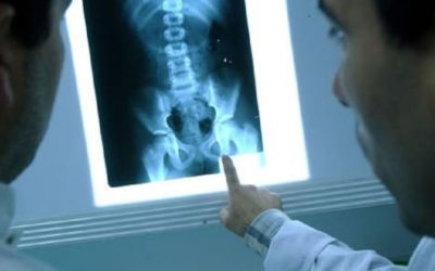 El Día de la Radiología, a 127 años del descubrimiento de los Rayos X